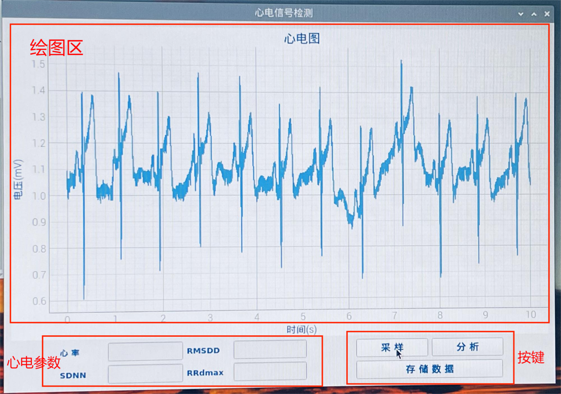 心电监测效果图